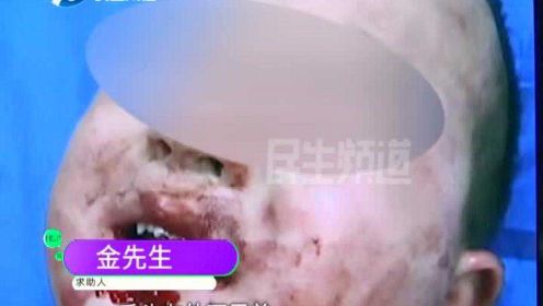 河南新乡：正常行驶中气囊突然弹出？两岁孩子严重受伤满脸是血