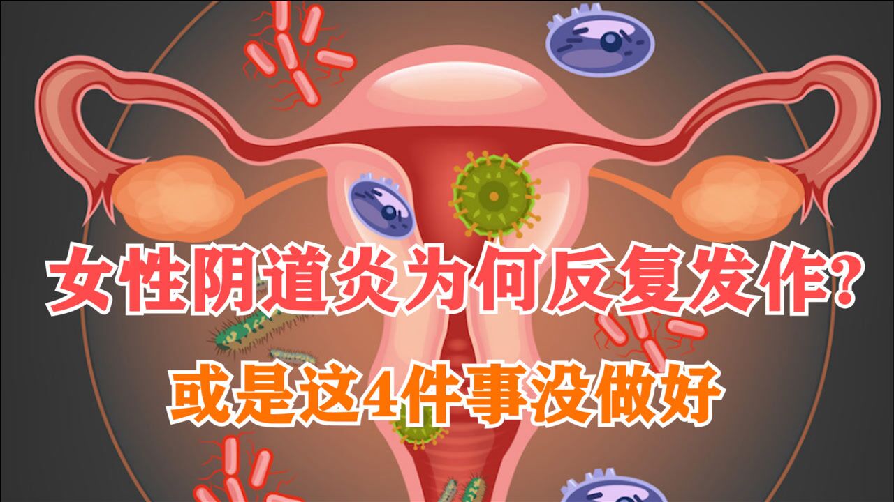 女性阴道炎为何反复发作?或是这4件事没做好，让它有可乘之机_腾讯视频