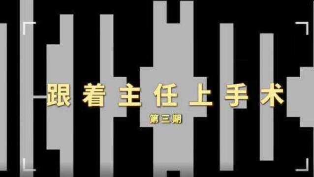 跟着主任上手术:显微镜下右侧额顶部镰旁脑膜瘤切除术昆明三博脑科医院 