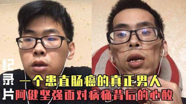 一个患直肠癌的真正男人阿健坚强面对病痛背后的心酸