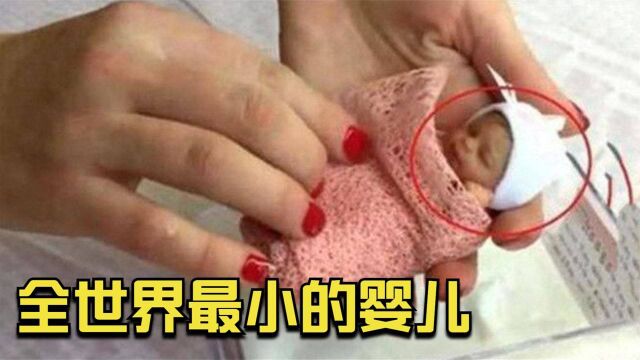 全世界最小的婴儿:出生只有25cm,被称拇指姑娘,如今怎样了?