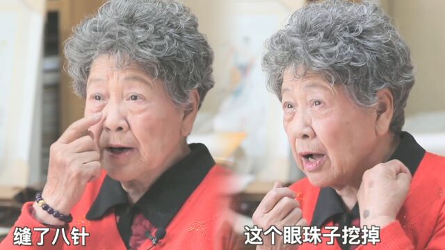 老戏骨陶玉玲自曝4次抗癌经历:挖眼珠取肿瘤,险些毁容令人唏嘘