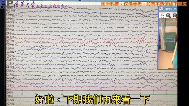 脑电图常见早发枕晚发枕