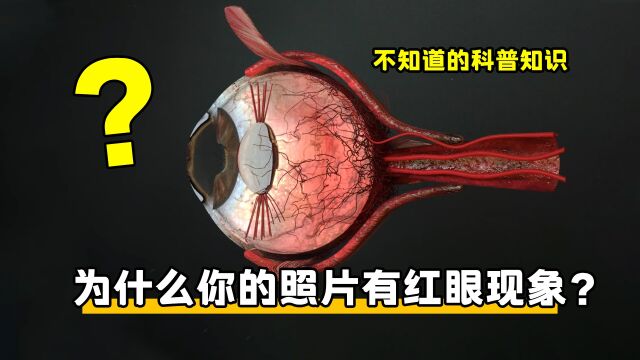 终于知道了,为什么有些数码照片有红眼的现象,没想到因为这个