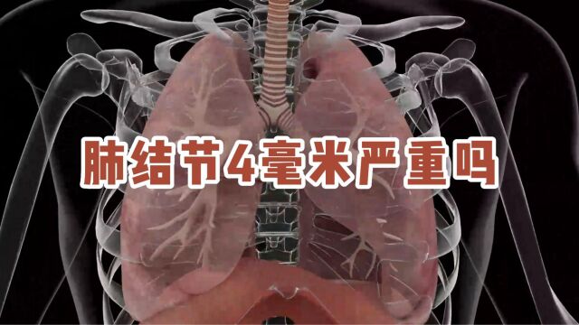 肺结节4mm严重吗?吃什么可以散结