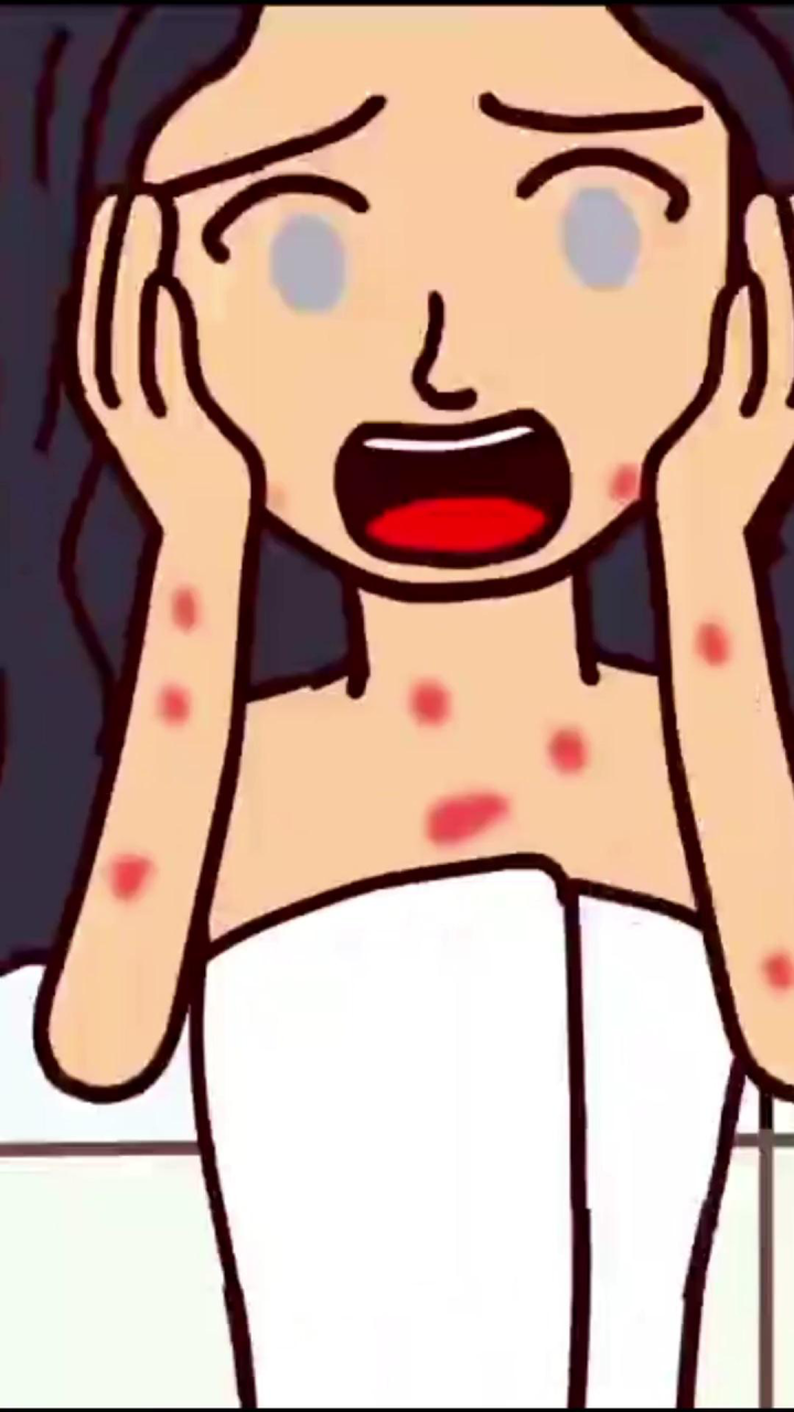 疥疮怎么晚上那么痒?怎么办?