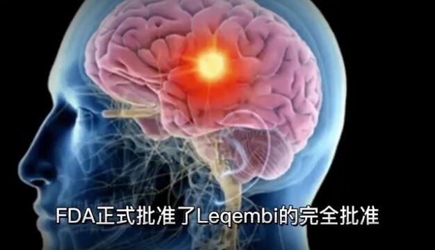 阿尔茨海默病新药落地海南乐城,每瓶定价3328.2元