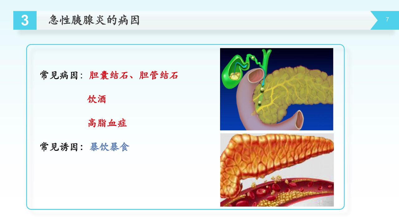 急性胰腺炎健康知识宣教_高清1080P在线观看平台_腾讯视频