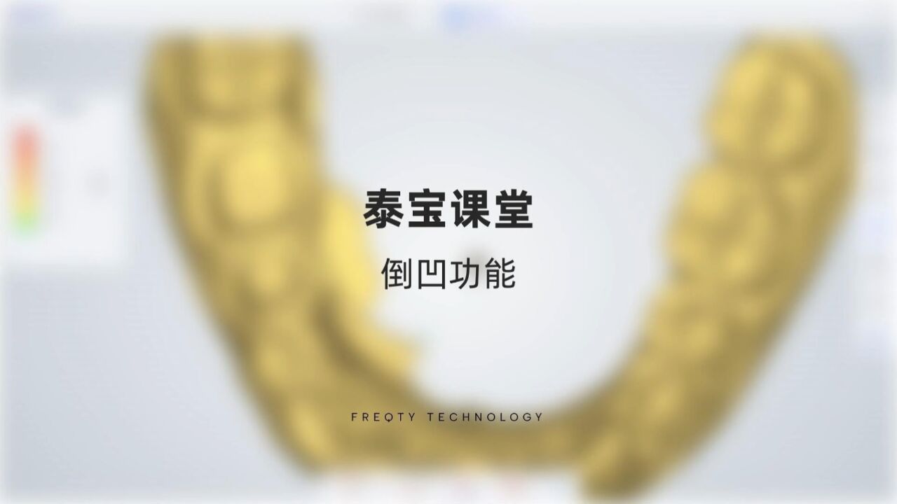 #泰宝课堂#频泰口扫倒凹功能演示。辅助确认就位方向,提高椅旁预判性,增效医技沟通,有效降低返工率。_高清1080P在线观看平台_腾讯视频