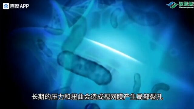 角膜塑形镜的危害安全视力防控就选视觉新势力