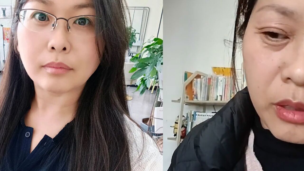 42岁女子20内断崖式衰老,皮肤变皱眼袋变大,前后对比令人唏嘘_高清1080P在线观看平台_腾讯视频