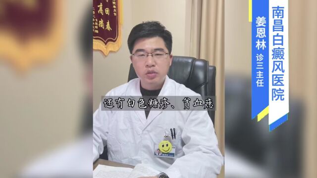 南昌哪个医院看白癜风好:长白斑就是白癜风吗