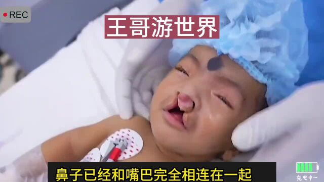 丈夫在妻子怀孕期间给炖米奇吃,导致妻子生出来的孩子变成这样!