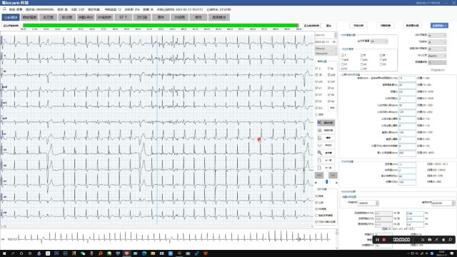 邦健医疗 动态心电操作讲解