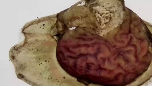 致死率高达97%的食脑虫，那么它是如何啃食大脑的