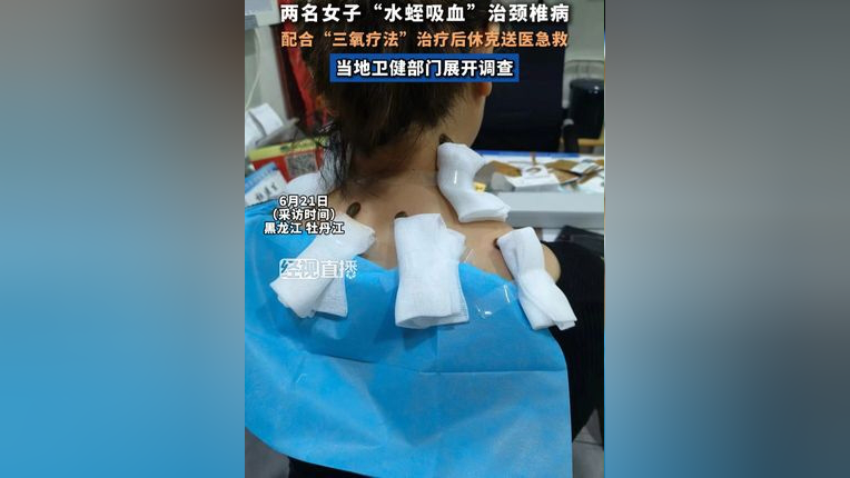 两名女子"水蛭吸血"治颈椎病, 配合"三氧疗法"治疗后休克送医急救