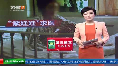 广州 “紫娃蛙”求医  医生助其重获新生