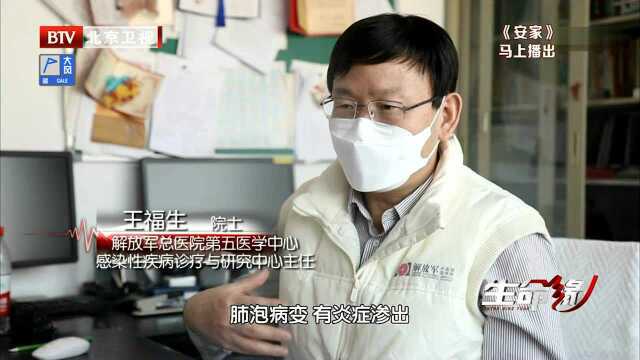 新冠重症患者进行干细胞治疗