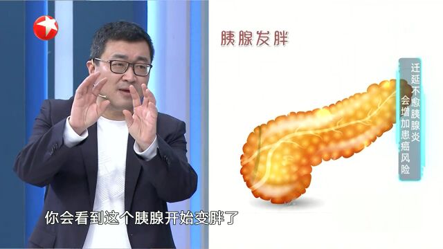 迁延不愈胰腺炎会增加患癌风险