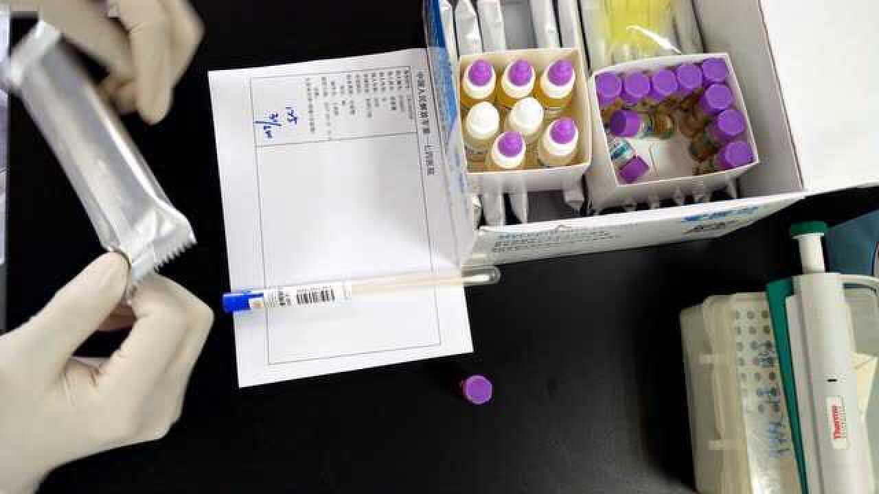 微生物检验教学视频系列之支原体培养鉴定及药敏试验_高清