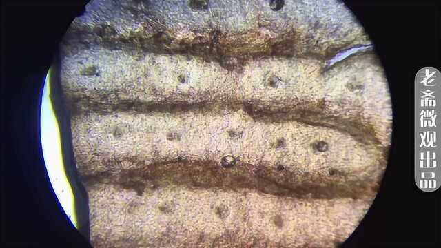 脚气真菌图片 显微镜图片