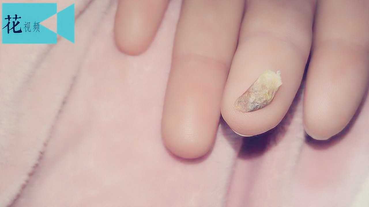 搓一搓,就能补肾壮腰延长寿命侃侃养生01:50高血糖不能吃这6种食物,高