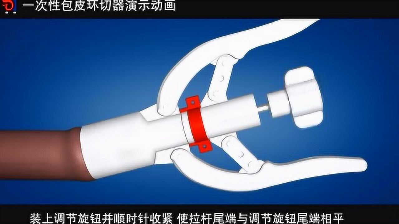 一次性包皮环切器演示动画_腾讯视频