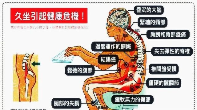 久坐不动易患肌腱炎,如何保养?