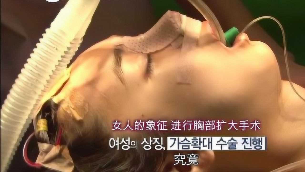 做变性手术做女人图片