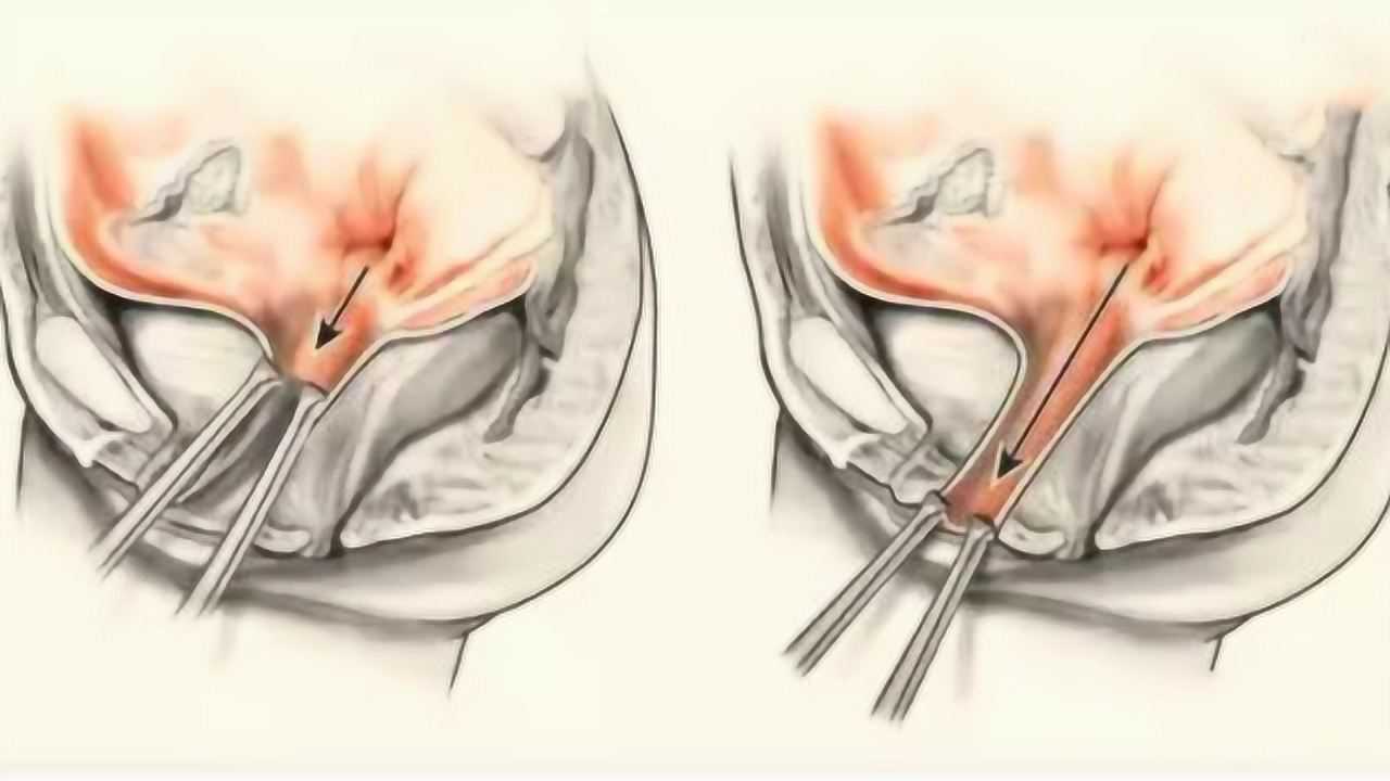 石女是什么意思?为何男人对其敬而远之?看完你还敢娶