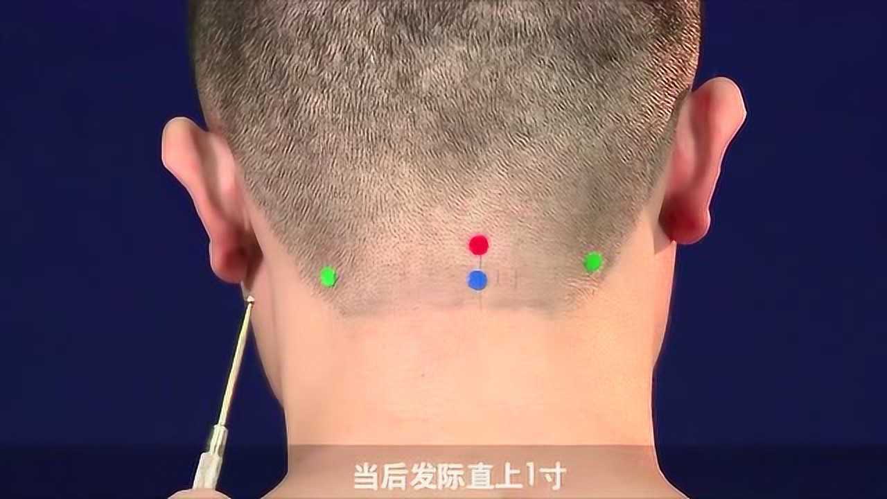 风府准确位置图和作用_腾讯视频