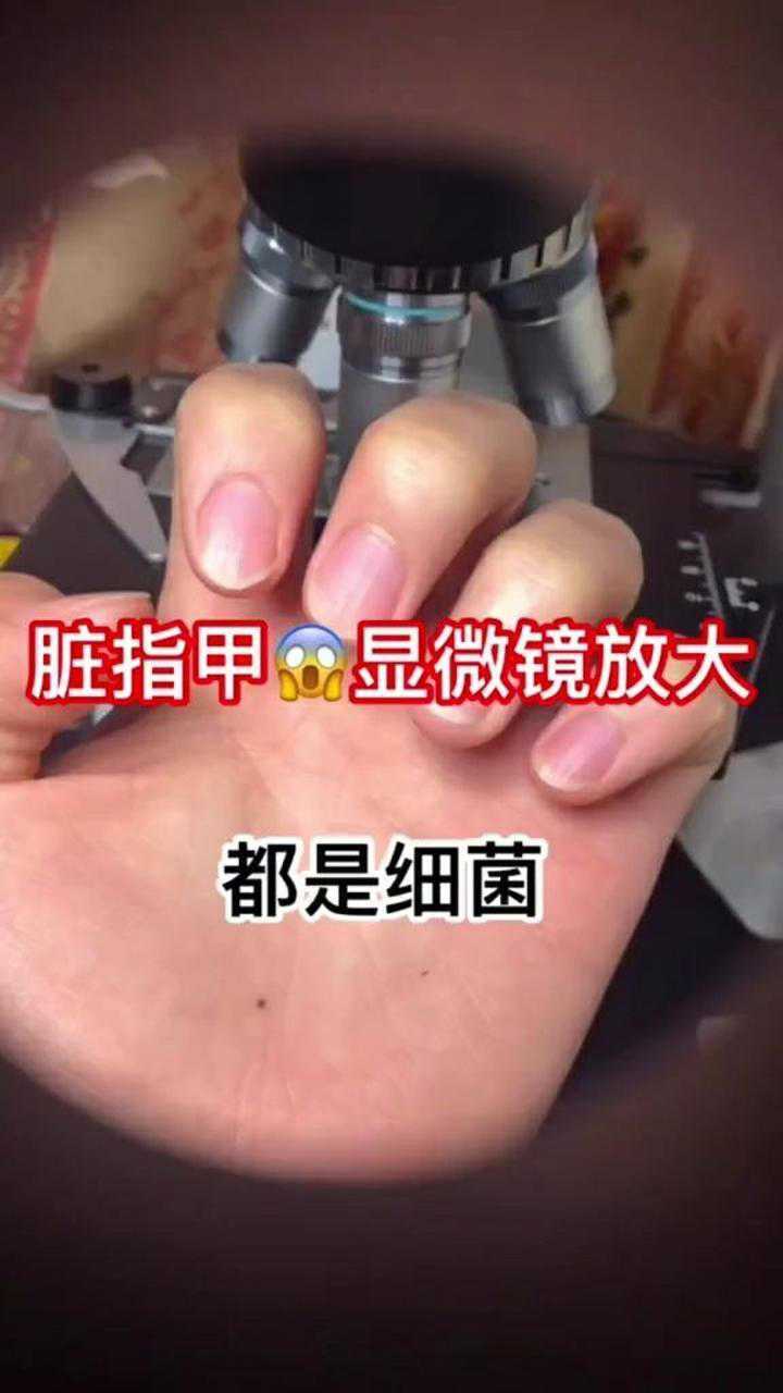 指甲放大后居然有这么多细菌