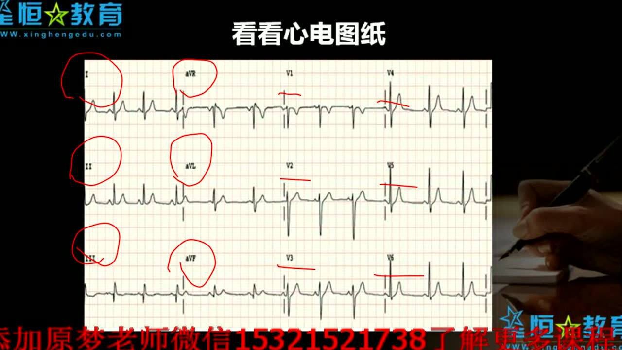 最详细心电图讲解_高清