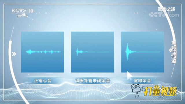 正常心音与动脉导管未闭杂音有何区别?来听听就明白了