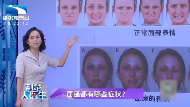 “一笑就嘴歪”怀疑自己得了面瘫,来看面瘫的三大症状你是否符合