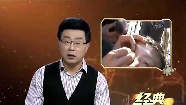 经典:现场演示眼中挑牙虫,药水一摸黑虫就接连挑出,治牙痛效果明显