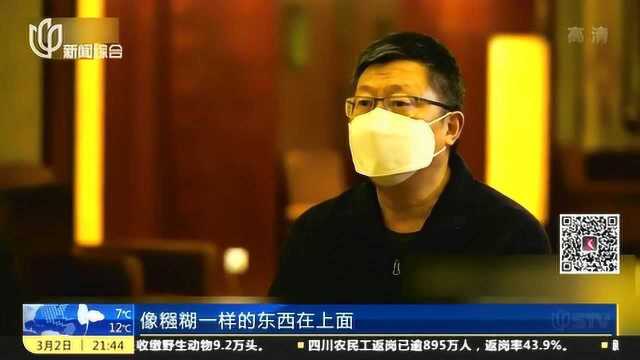 新冠肺炎死因研究分析:肺部黏液过度 氧气无法进入肺泡进行气体交换