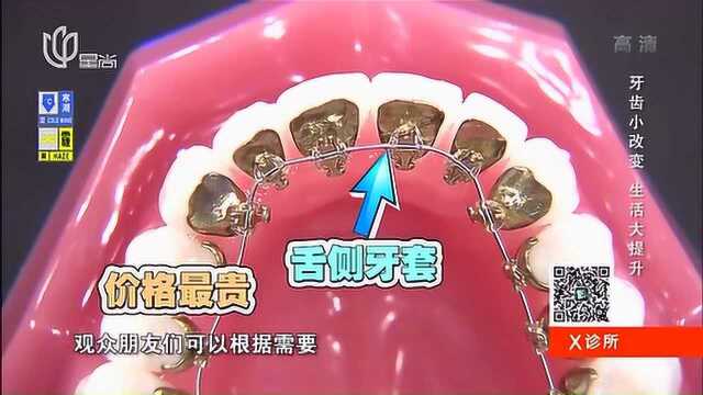 你还在带普通牙套?不仅不美观还不方便,看看更多种类!