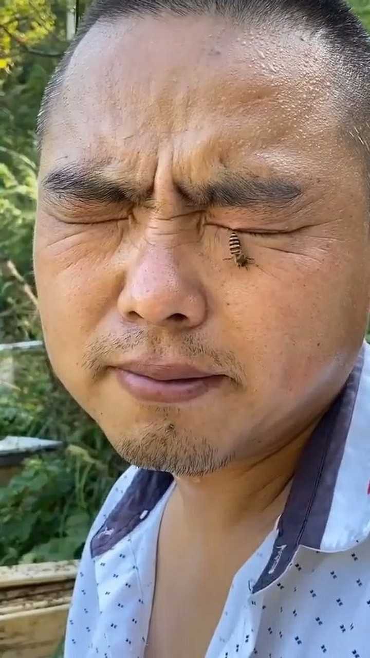 我的妈呀,蜜蜂蛰到我眼睛了