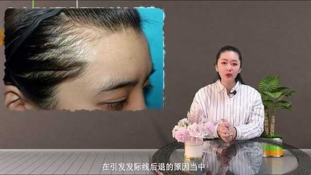 滋森漫:脱发掉发怎么办 如何防脱增发 什么原因引起发际线后移