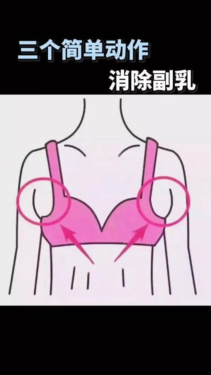 三个简单动作消除副乳