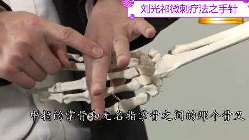 刘光祁：你知道手上的腰邸点吗？一个可以排中焦下焦病气的通道，中科宏宇微刺疗法针灸教学。