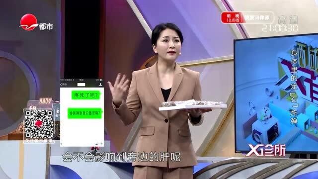 人体中的定“石”炸弹究竟有多珍贵?还可以拿出来卖?听听专家怎么说