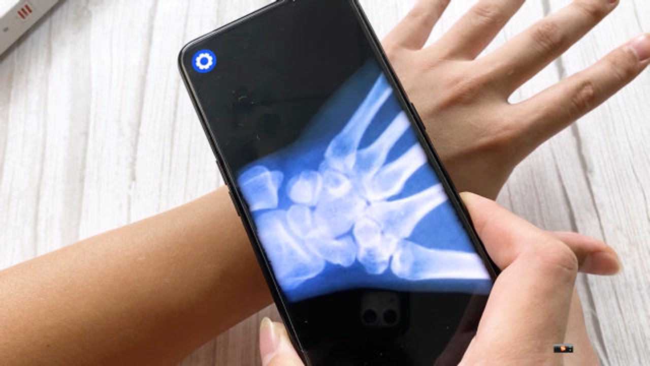 手机也能拍x光非常有趣快来看看怎么设置的吧