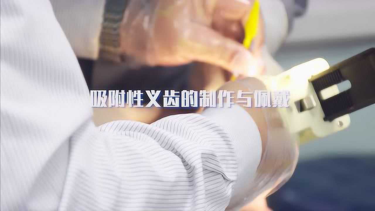 吸附性义齿的制作与试戴_高清