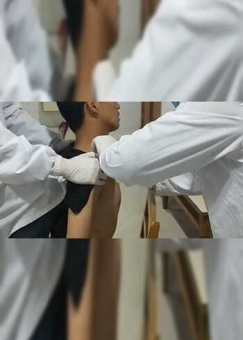 锁骨骨折手法复位术#万安县人民医院