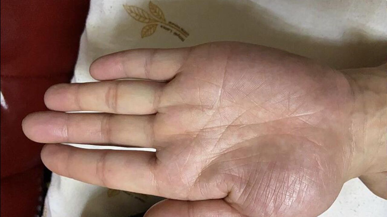 女人朱砂掌手相朱砂掌手相的人一辈子大富大贵金玉满堂