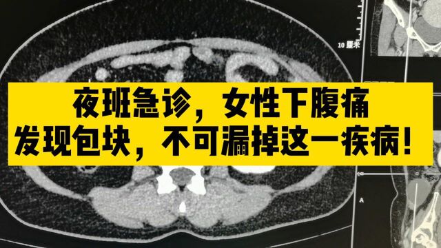 夜班急诊,遇到女性下腹痛CT检查,一定要关注双侧附件区,除外蒂扭转!