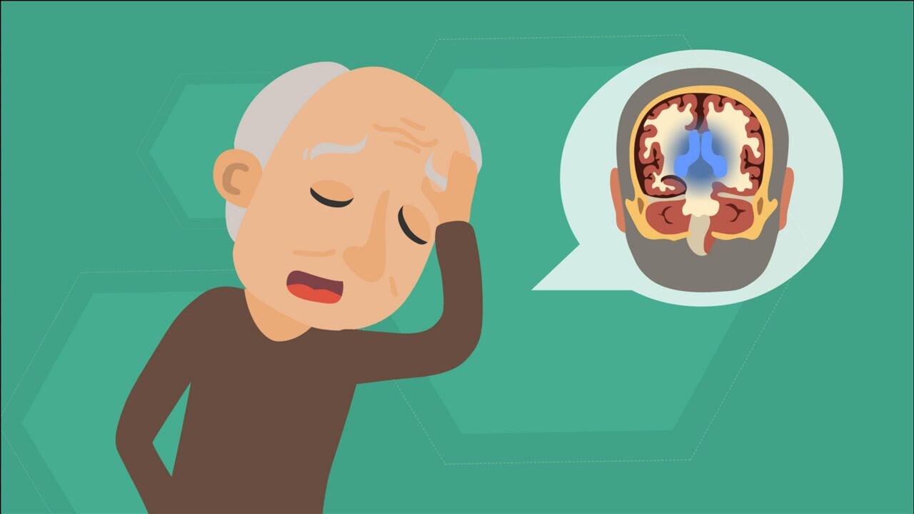 3个症状一出现警惕脑积水潜伏已久老年人需及时察觉