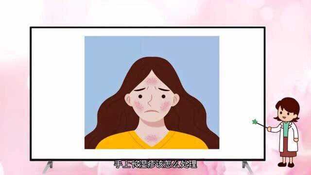 湿疹反复发作怎么才能根除?这些生活细节不容忽视